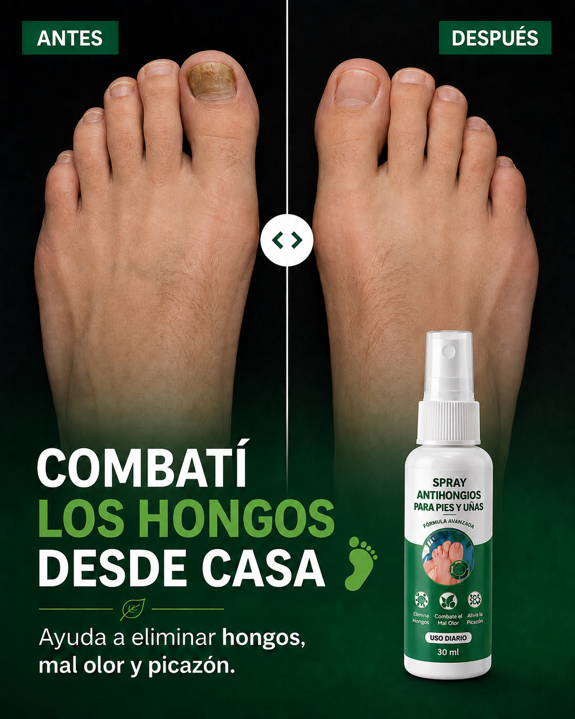 Spray Anti-Hongos Para Pies y Uñas | Pago al Recibir