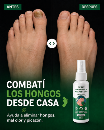 Spray Anti-Hongos Para Pies y Uñas | Pago al Recibir